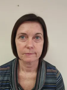 Madeline Winchester Facial Palsy | Hobbs Rehabilitation